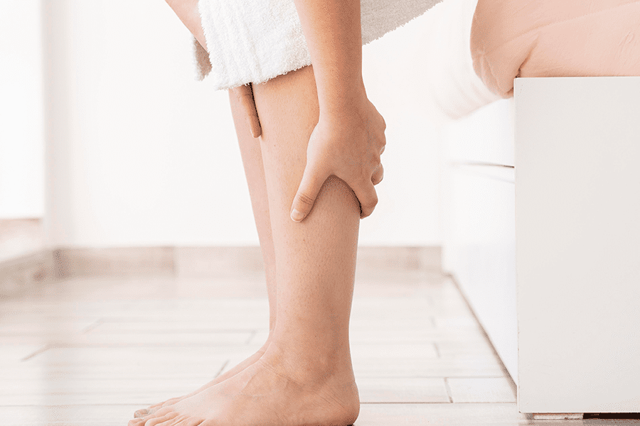 Patient shows off legs after successful Treatment for Varicose Veins